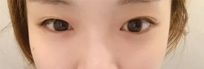 [Mắt] Gấu trúc xanh - Mắt