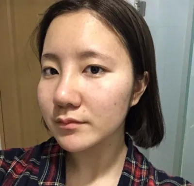 [Mũi] Lee Wonder - Mũi