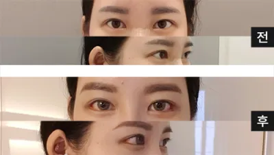 [Mắt] Nikkui - Mắt