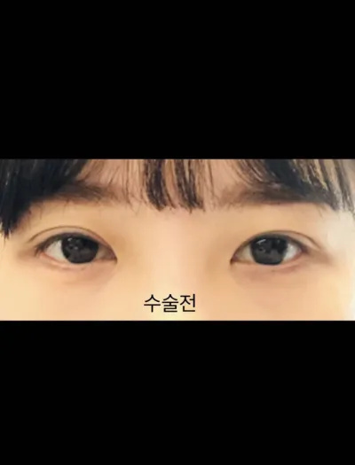 [Mắt] Juhee95 - Mắt