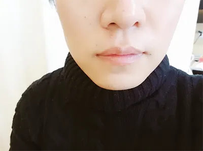 [Tiểu phẫu] Runly Runly - Nâng cơ