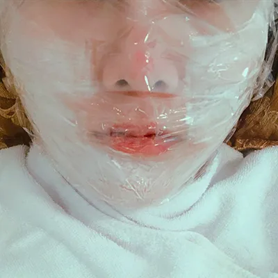 [Tiểu phẫu] yj1221 - Nâng cơ