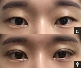 [Mắt] 구름이맑음 - Mắt