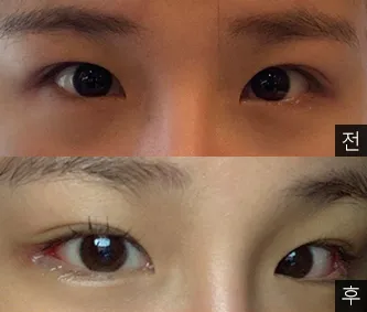 [Mắt] Dalijjanginuna - Mắt