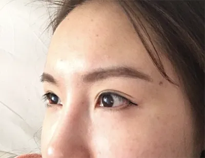 [Mắt] Lai Lai Lai - Mắt