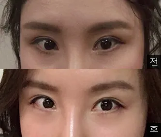 [Mắt] Lai Lai Lai - Mắt