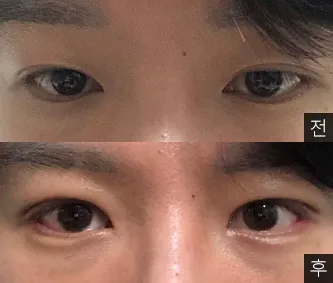 [Mắt] Changbak - Mắt