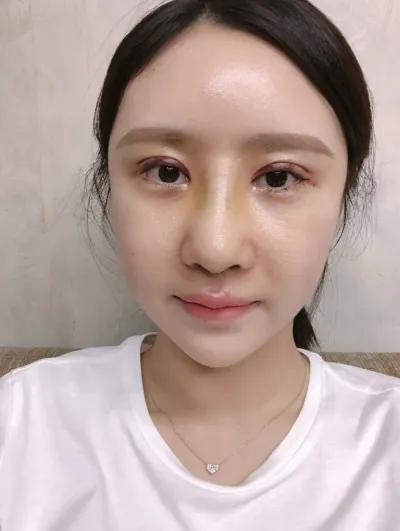 [Mũi] JW Neu Vely - Mắt, Mũi