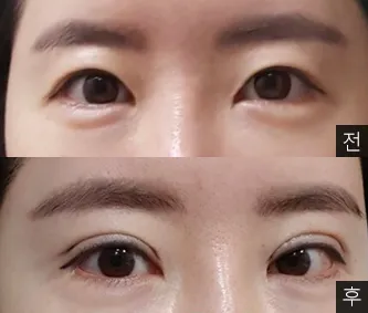 [Mắt] yahoooo - Mắt