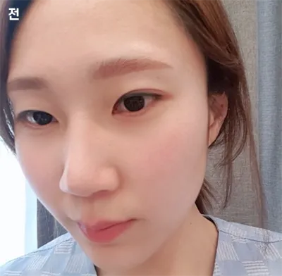 [Mắt] jipoi - Mắt