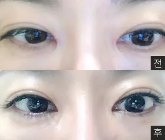 [Mắt] Kokakokyo - Mắt