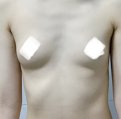 [Ngực] Irokoi - Ngực