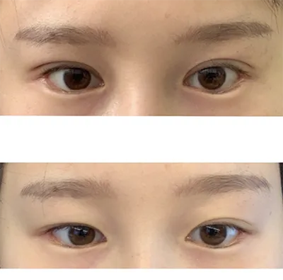 [Mắt] 참치마요잉 - Mắt