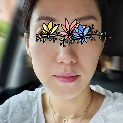 [Mũi] Chúm chím chụm chụm - Tiêm thu nhỏ đầu mũi, Botox thu gọn cánh mũi