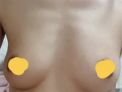 [Ngực] Heuit - Ngực