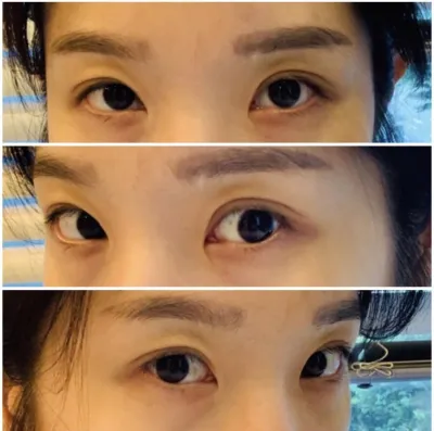 [Mắt] Tta Ddan Bli - Mở góc mắt trong, mở góc mắt trên