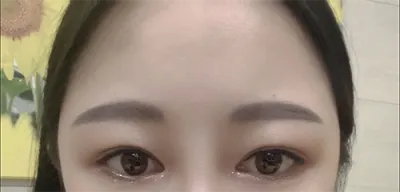 [Mắt] eproti - Mắt