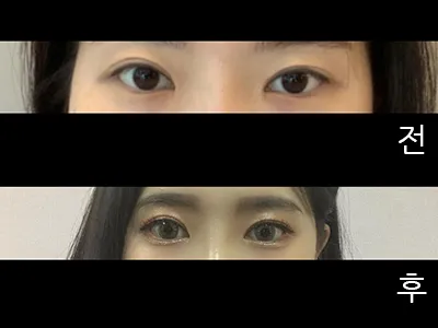 [Mắt] Hyuna Jju - Mắt