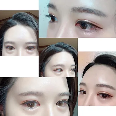 [Mắt] sjsi2 - Mắt