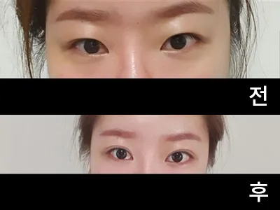 [Mắt] Jang Min-ah - Mắt