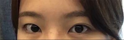 [Mắt] Dori Dori a - Mắt