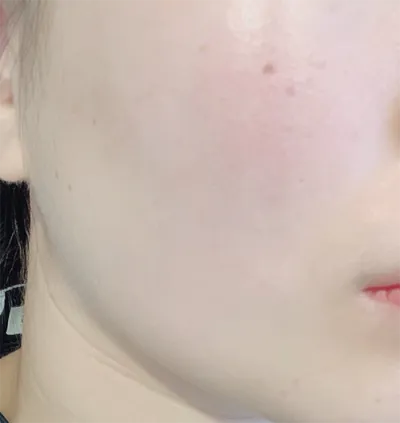 [Da] Shot Key Tokkyu - Nâng cơ Shrink