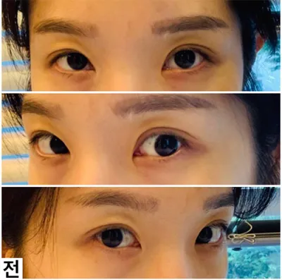 [Mắt] Tta-ttan-beul-ri - Mắt