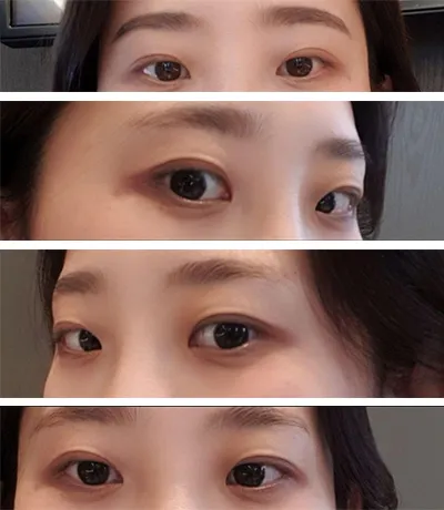 [Mắt] Sususukkotda - Mắt