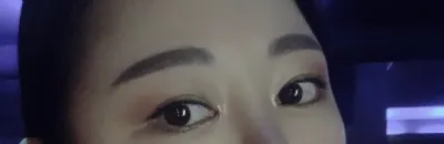 [Mắt] eproti - Mắt