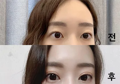 [Mắt] ski03078 - Mắt