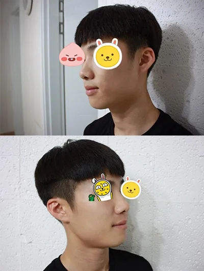 [Mũi] Ai chịu trách nhiệm cho chiếc mũi của mình? - Mũi