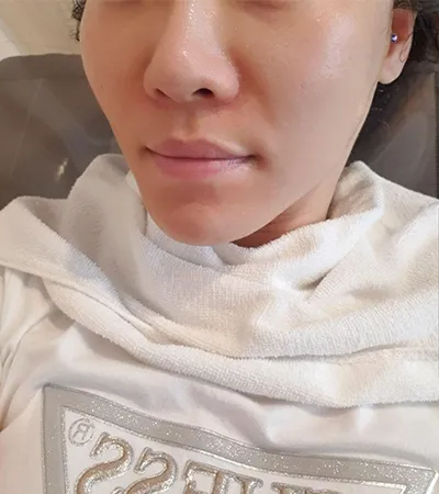 [Da] Bong Berry - Air Shrink