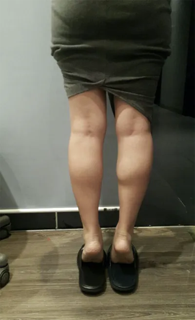 [Tiểu phẫu] Hương mẹ - Bắp chân