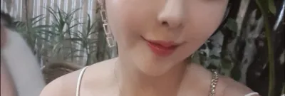 [Tiểu phẫu] Kkukkururu - Tiêm filler môi, căng chỉ