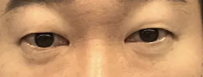 [Mắt] Boodada - Mắt