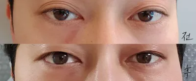 [Mắt] Tan Tan Doble - Mắt