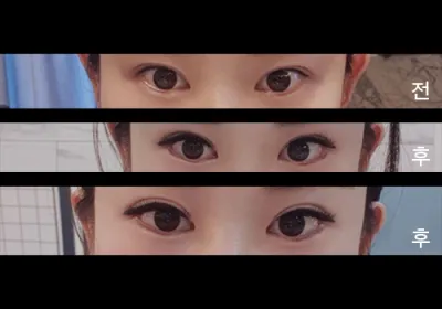 [Mắt] Seobly9999 - Hạ mí, mở rộng góc mắt ngoài