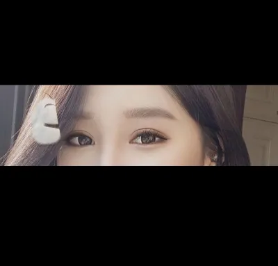 [Mắt] YeniYen1017 - Cắt mí