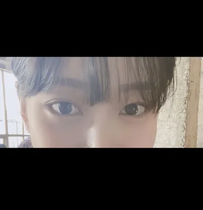 [Mắt] yong0423 - Mở rộng góc mắt ngoài, Hạ góc mắt dưới