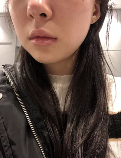 [Da] Hanahaneung - Nâng cơ bằng máy Shrink