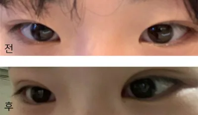 [Mắt] Choki1234 - Mắt