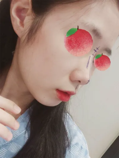 [Mũi] Dodosmoothie - Mũi