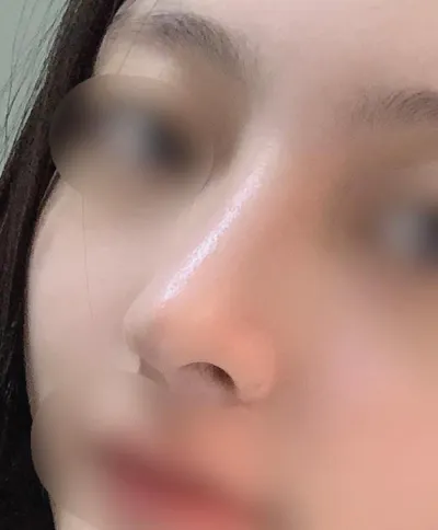 [Mũi] 쥬비0111 - Mũi