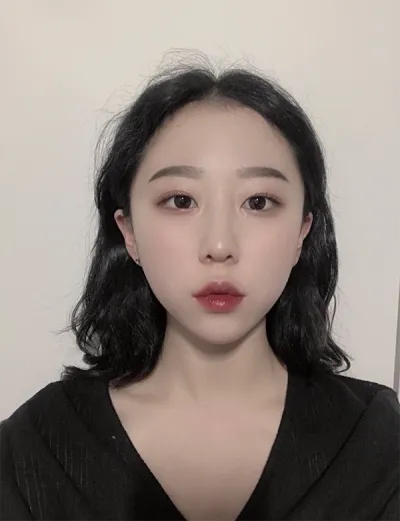 [Tiểu phẫu] Mangosuna đêm khuya - Botox, Filler