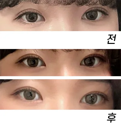 [Mắt] qhrehd - Mắt