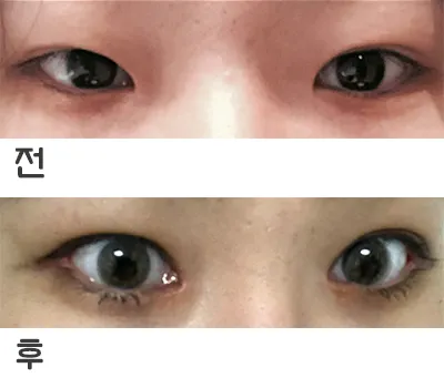 [Mắt] jdnendndj - Mắt