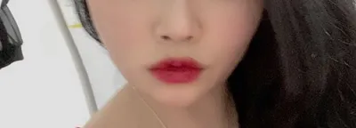 [Da] sSoyeon s - Ultherapy, Chanel