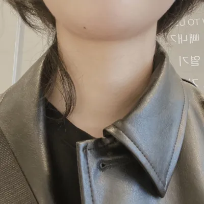 [Tiêm thẩm mỹ] Gold.Gold. - Tiêm tan mỡ