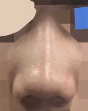 [Mũi] Gana Suesusu - Mũi