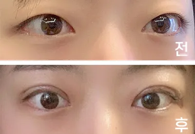 [Mắt] Chóp mũi s2 - Mở góc mắt trên, chỉnh sửa mắt